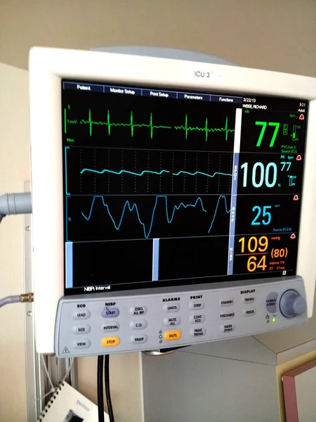EKG, pulzus, vérnyomás és légzés Intenzív monitor képernyő — Stock Fotó
