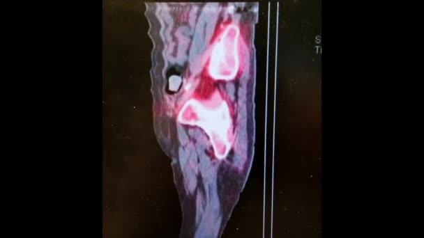 SPECT CT de la pelvis que muestra anatomía ósea — Vídeos de Stock