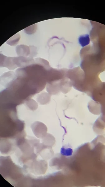 Trypanosoma rhodesiense организмы - восточноафриканская болезнь сна — стоковое фото