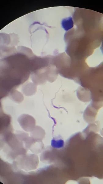 Trypanosoma rodezez organizmaları - Doğu Afrika Uyku Hastalığı — Stok fotoğraf