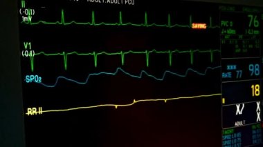 EKG, Nabız, Oksijen ve Solunum Yoğun Bakım Ekranı