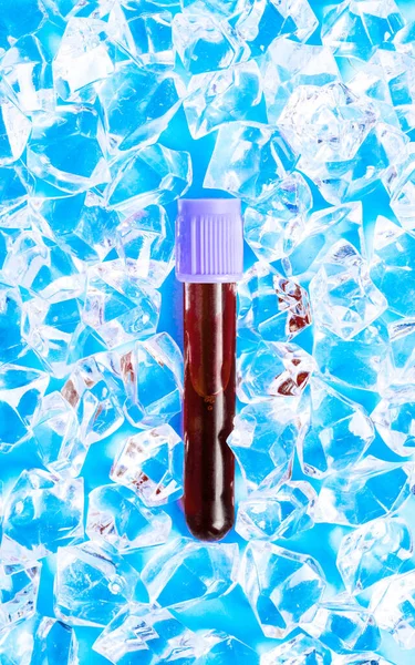 Testbuis Met Bloed Ijs Bloedtest Biotest Dna — Stockfoto