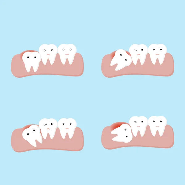 Dientes Impactados Muelas Del Juicio Enfermedades Dentales Orales Vector Ilustración — Vector de stock