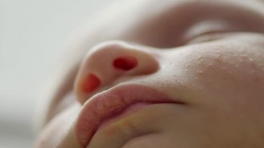  Diatezden etkilenmiş uyuyan bir çocuğun makro görüntüsü. Kafkasyalı küçük bir bebeğin sorunlu yüzü. Çocukların cilt kusurlu yüzlerinin sinematik görüntüleri. Bebeklerin yanaklarının yakın çekim görüntüleri. Bebek yüzünün yakın çekim görüntüsü.