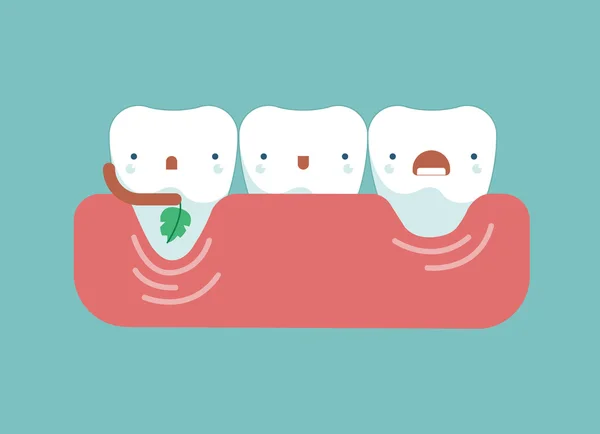 Recesión gingival, concepto dental — Archivo Imágenes Vectoriales