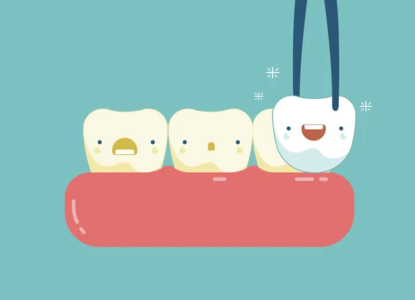Folheados dentes de conceito dental — Vetor de Stock