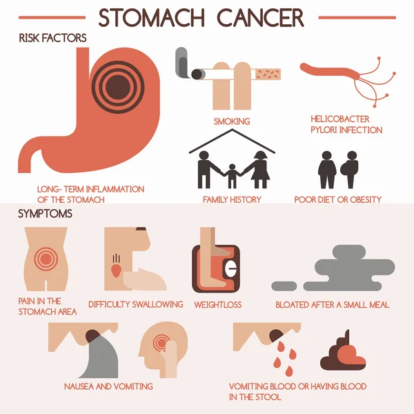 Vector de cáncer de estómago eps 10 — Archivo Imágenes Vectoriales