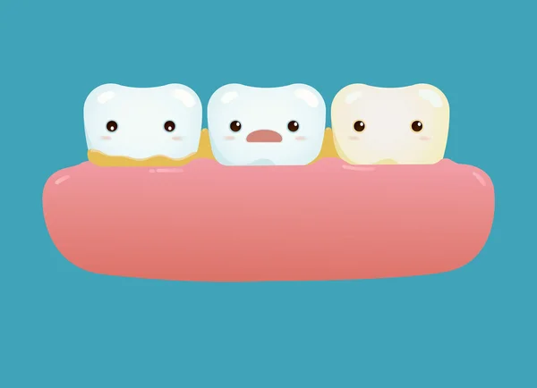 Piszkos fogak — Stock Vector