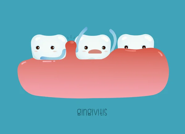 Gingivitis del vector dental — Archivo Imágenes Vectoriales