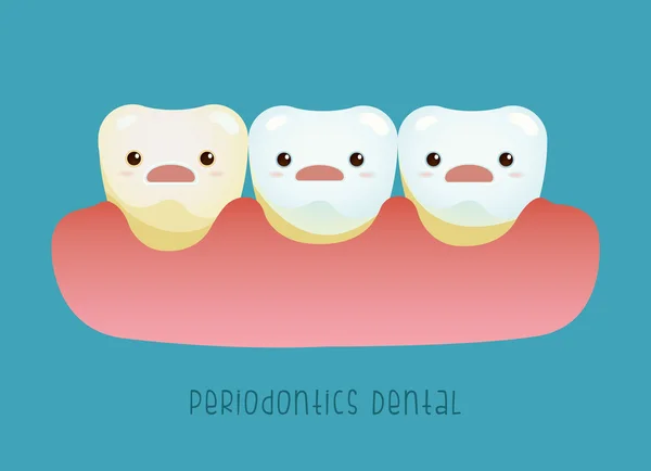 Periodontics diş vektör kavramı