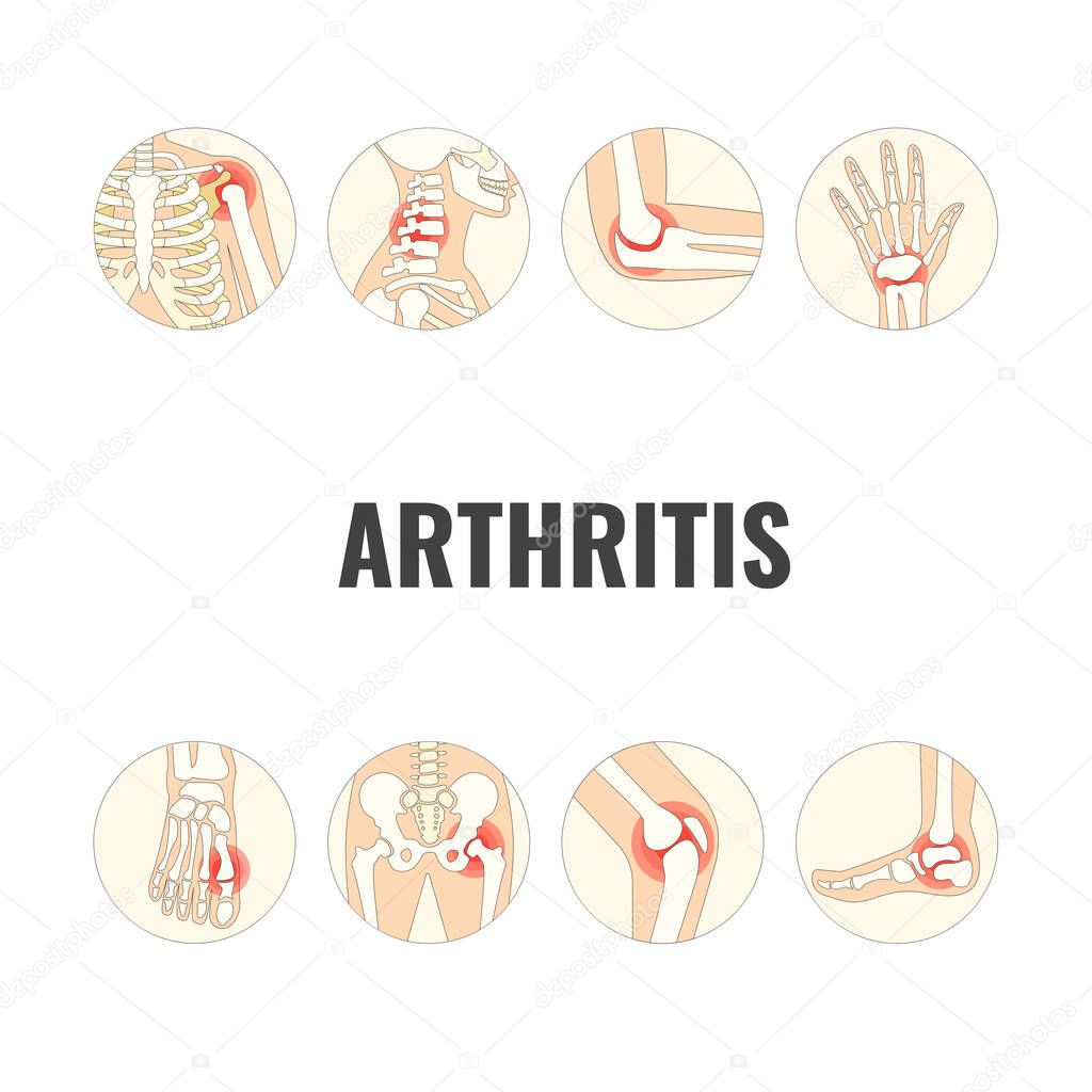 Vector Illustration of World Arthritis Day