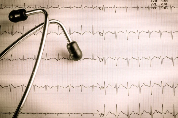 Medical examination, electrocardiogram, heart medicine and thera — Stock Photo, Image