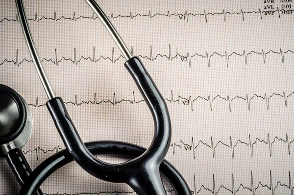 Медичний огляд, електрокардіограма, серцева медицина та тера — стокове фото