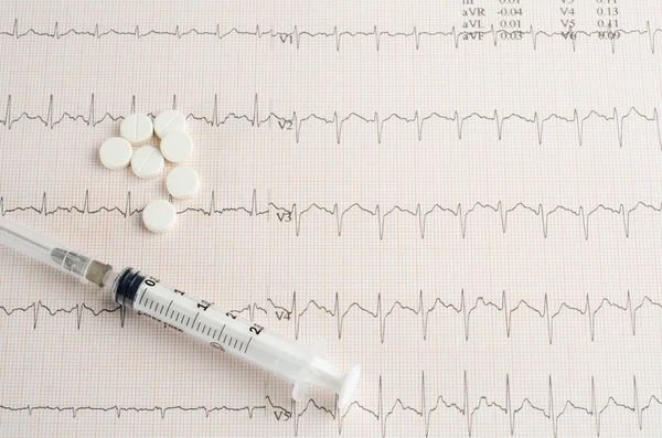 Medisch onderzoek, elektrocardiogram, hart geneeskunde en therapie — Stockfoto