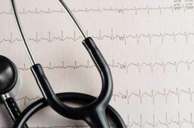 Tıbbi muayene, Elektrokardiyogram, kalp ilaç ve terapi