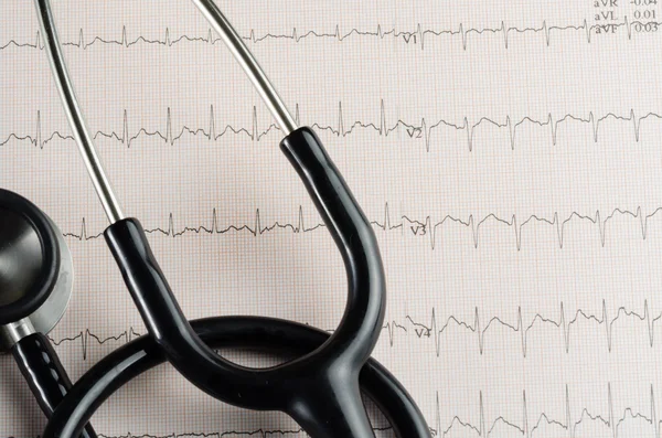 Tıbbi muayene, Elektrokardiyogram, kalp ilaç ve terapi