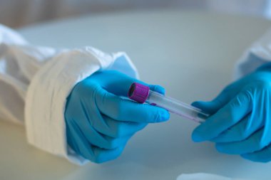 Laboratuvarda hemşire doktor tarafından yapılan koronavirüs testi incelemesi, COVID-19 örnek toplama kiti, OP NP hasta numunesi almak için tüp,