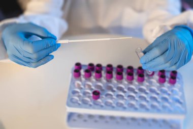 Laboratuvarda hemşire doktor tarafından yapılan koronavirüs testi incelemesi, COVID-19 örnek toplama kiti, OP NP hasta numunesi almak için tüp,