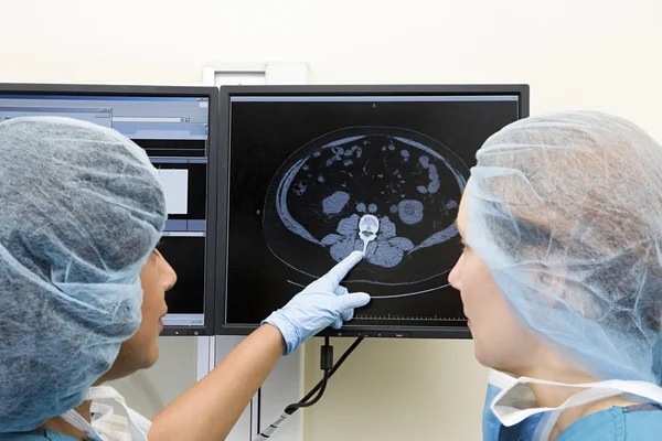 Surgeons looking at scan on computer monitor — Stock Photo, Image