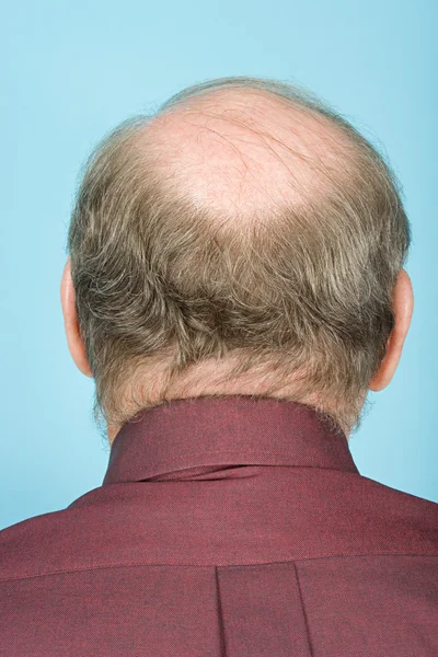 Rear view of balding man