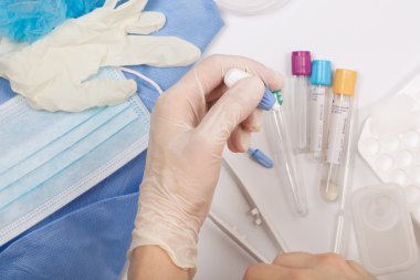 Kan analysi çekmeden önce bir fingerstick laborant geçerlidir