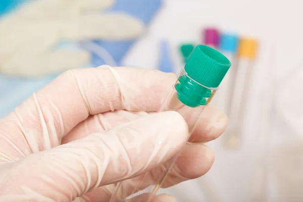 Tubo de ensayo en la palma de un técnico de laboratorio. Primer plano. — Foto de Stock