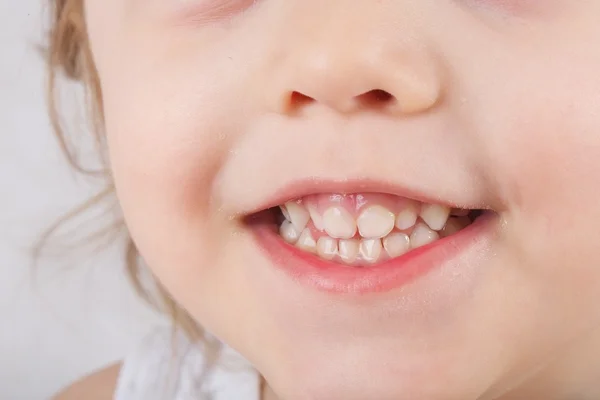 Dentes de uma criança de três anos — Fotografia de Stock