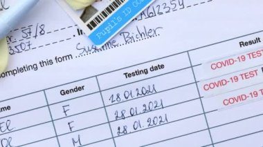 Laboratuvar teknisyeni COVID burun temizleme örneğini kapatıyor. - Yakın çekim. Biçimdeki bilgi gerçek verilere dayanmıyor.