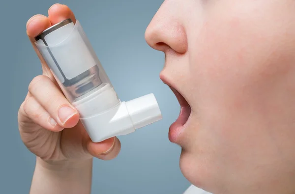 Astmatische vrouw lijdt aan astma en inhalator in de hand houdt. — Stockfoto