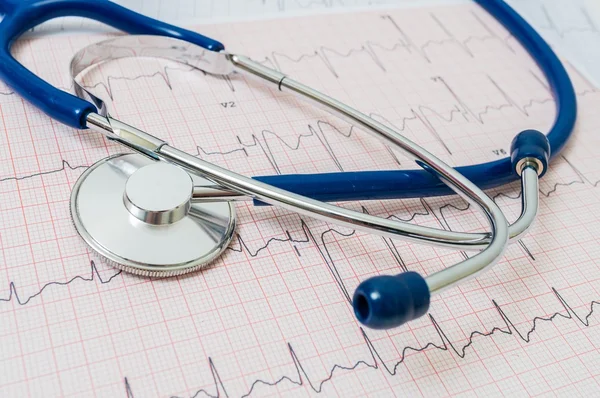 EKG / Ekg diagram és sztetoszkóp. Sürgősségi koncepció. — Stock Fotó