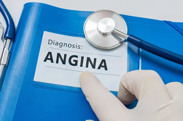 Diagnóstico de angina de pecho en carpeta azul con estetoscopio . — Foto de Stock