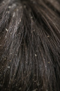 Kuru teline beyaz kepek gevreği.