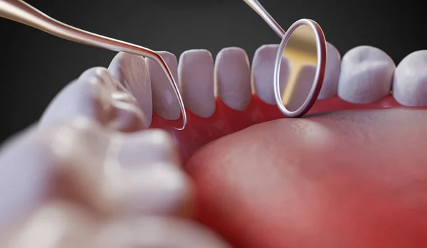 View on teeth from inside of mouth during examination at the dentist. 3D rendered illustration.