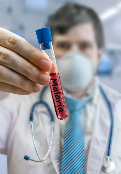 Research in cure for Malaria, doctor holds test tube — Stock Photo, Image