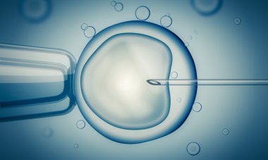 IVF (Tüp Bebek döllenme) ya da mikroskop ile dişi yumurta döllenme. Dijital illüstrasyon.