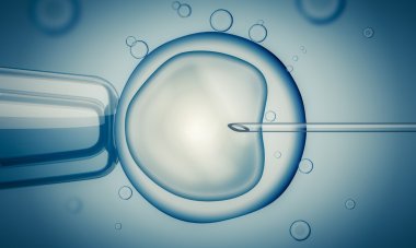 IVF (in vitro fertilisation) or insemination of female egg with microscope. Digital illustration. clipart