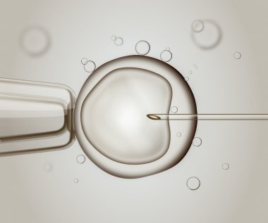 Makro IVF (Tüp Bebek döllenme). Döllenme insan yumurta. Dijital illüstrasyon.