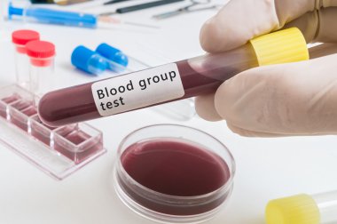 Tüp Bloof grup testi için kan ile bilim adamının elini tutar