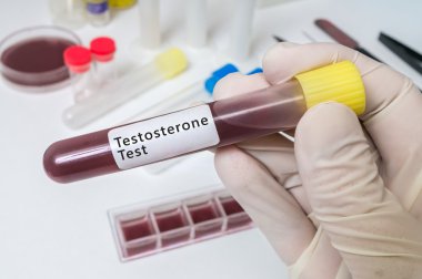 El testosteron testi için test tüpü tutan.