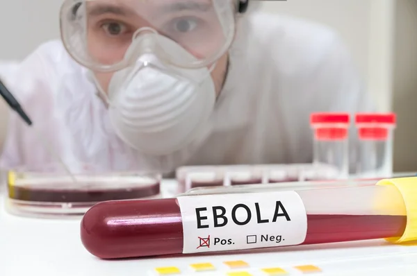 Researcher in laboratory is analyzing blood sample in test tube for Ebola. — Stock Photo, Image