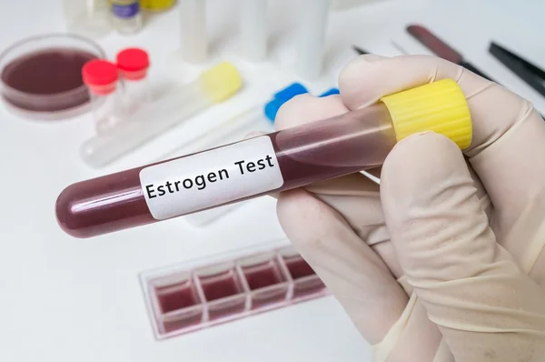 Hand holds test tube with blood for Estrogen Test. — Stock Photo, Image