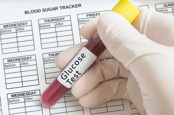 Mantiene un tubo de prueba con sangre para la prueba de glucosa para reconocer la diabetes — Foto de Stock