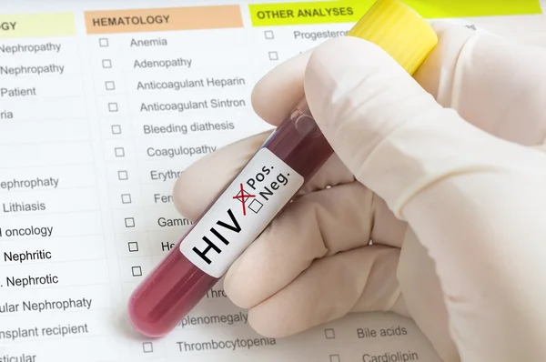 Tangan memegang tabung tes dengan darah untuk tes HIV . — Stok Foto