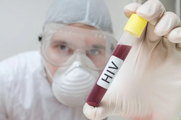 Researcher holds test tube with blood for analyzing HIV — Stock Photo, Image