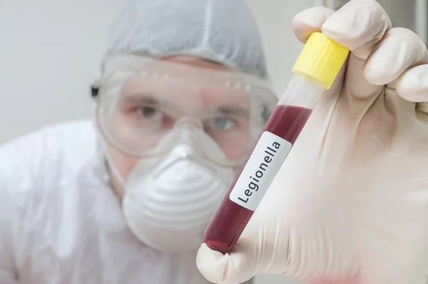 Researcher in laboratory holds test tube with Legionella blood sample — Stock Photo, Image