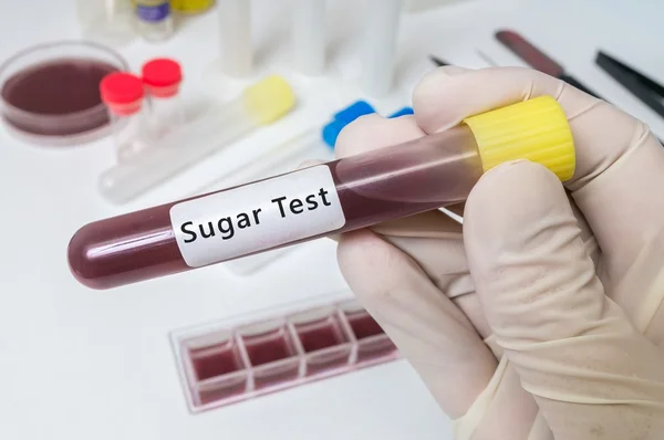 Tubo de ensayo con sangre para la prueba de azúcar para el paciente diabético . — Foto de Stock