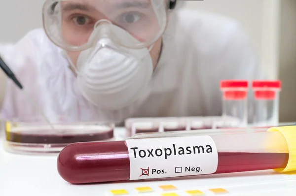 Le chercheur analyse le tube à essai avec du sang pour Toxoplasma . — Photo