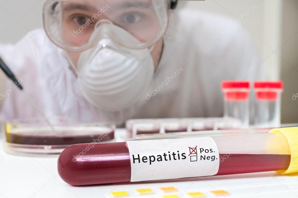 Test tube with blood for Hepatitis test in fron of researcher