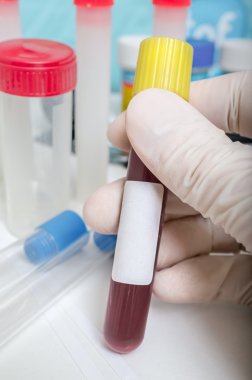 Tüp kan ve özel etiket için boş alan ile el tutar