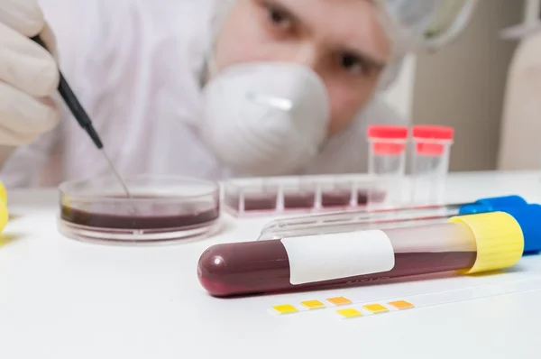 Scientist or researches is analyzing blood in test tube. — Stock Photo, Image